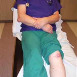 Immediate Gout Relief - What Tests Are Commonly Used To Diagnose Gout?