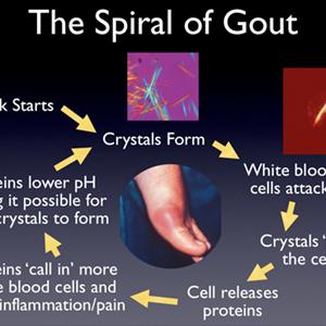 Gout Heat - Gout Natural Remedy